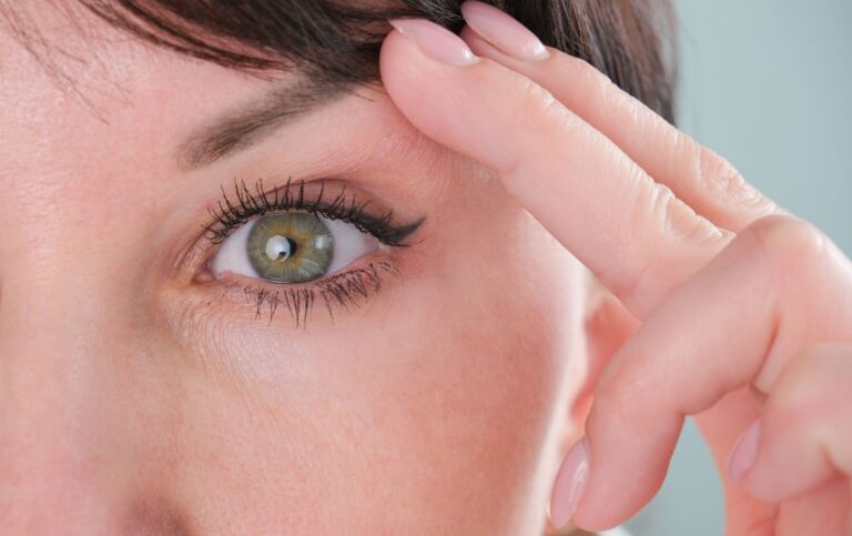 paupières tombantes