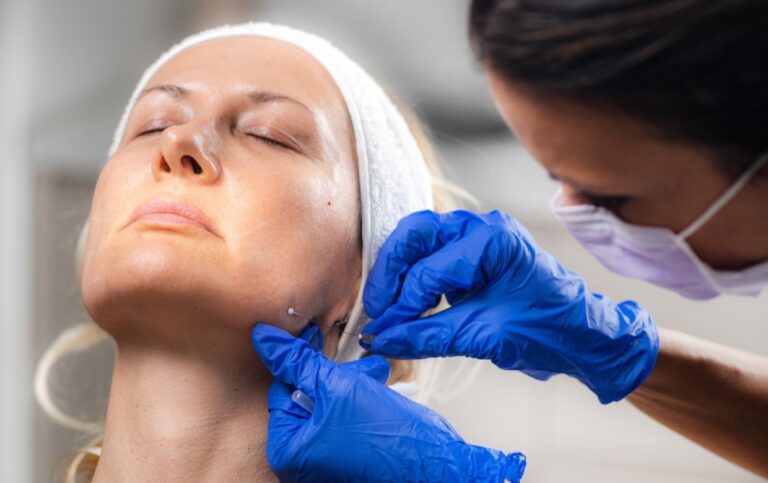 lifting visage